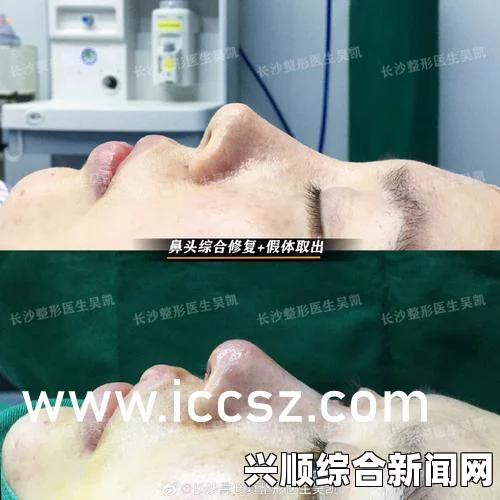 伊拉克极端组织绑架数百名年轻女子，性奴危机背后的真相揭秘