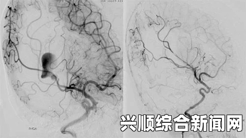 我的世界穿刺有什么用