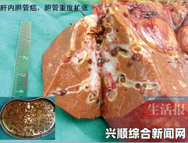 日本发现狗粪寄生虫包虫卵，警惕人畜共患肝脏疾病