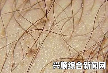 日本发现狗粪寄生虫包虫卵，警惕人畜共患肝脏疾病