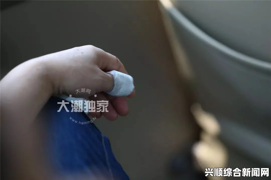 罗马尼亚男子工伤失去小半个脑袋奇迹生还