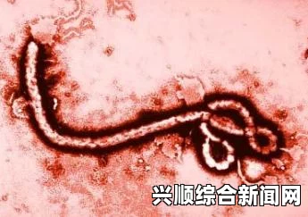 埃博拉病毒详解，传播、症状、检查与预防治疗全攻略